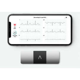 Kardia 6L ECG