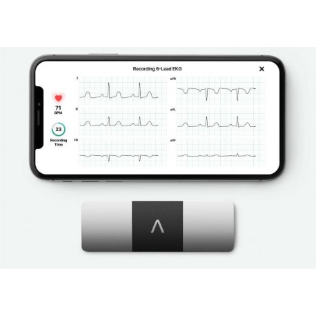 Kardia 6L ECG