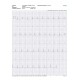 Kardia ECG